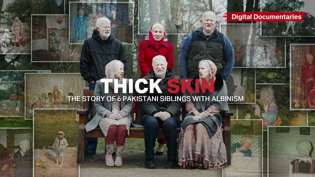 Thick Skin - The Story of 6 Pakistani Siblings with Albinism
