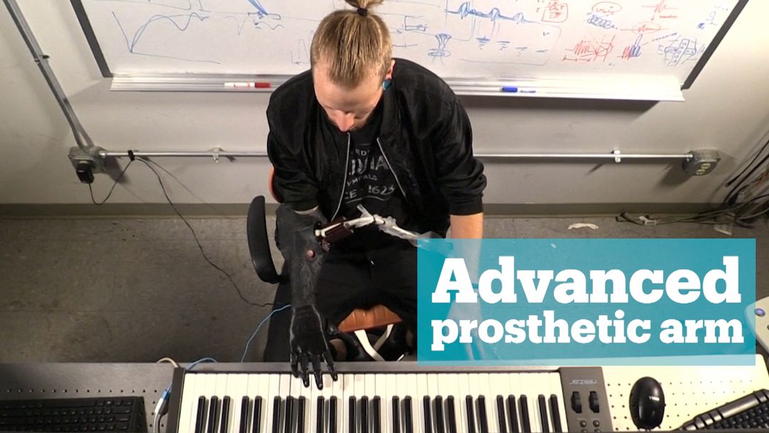 Advanced prosthetic arm for amputee musician
