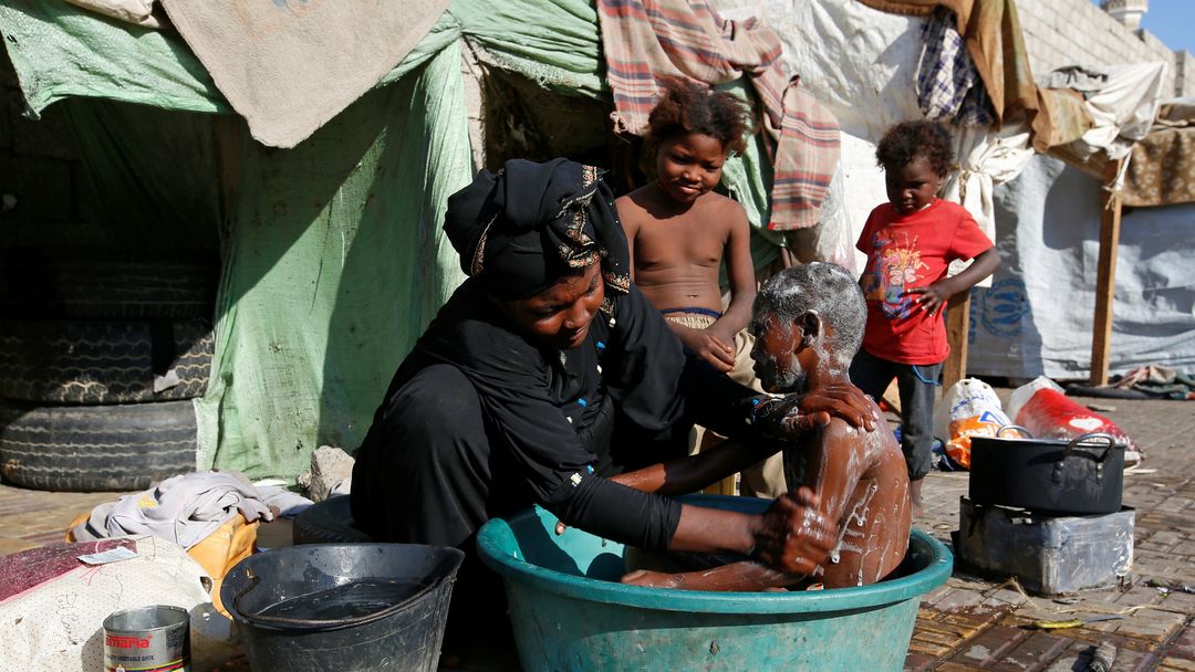 The War in Yemen: Lack of aid leaves many children malnourished