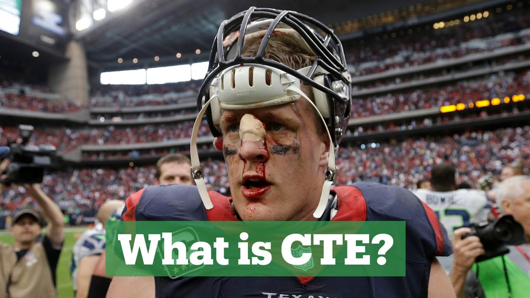 Brain disease found in 99% of deceased NFL players