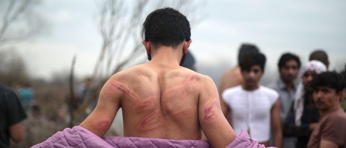 Refugees share ordeal of torture by Greek border forces