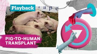 Playback: Surgeons successfully test pig kidney transplant in human patient