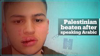 Palestinian Israeli boy beaten for speaking Arabic