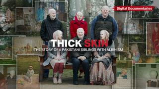 Thick Skin - The Story of 6 Pakistani Siblings with Albinism