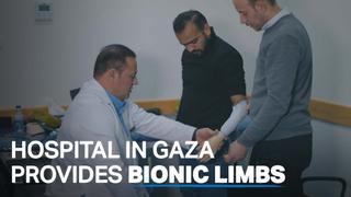 Gaza hospital giving bionic limbs to amputees
