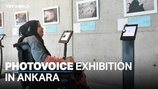Disabled refugees put on photo exhibit at Ankara gallery