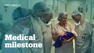 First baby born after womb transplant from dead donor