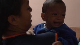 Venezuela Child Malnutrition: Families struggle to provide bare minimum