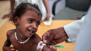 The War in Yemen: Doctor helps thousands by giving free medicine