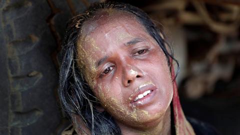 UN medics say Rohingya women injuries back rape claim against Myanmar army