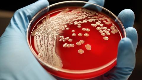 AI assisted by lasers to help predict antibiotic resistance in patients
