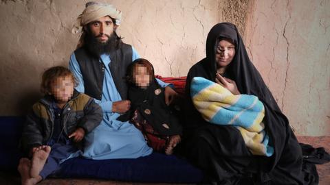 Afghans sell organs for living amid starvation