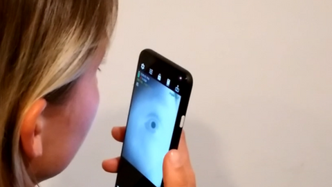 Smartphone app could screen for neurological diseases through your eyes