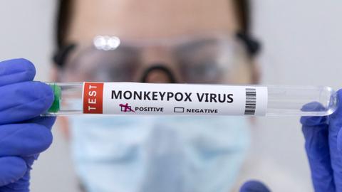 Confirmed monkeypox cases rise worldwide: EU disease agency