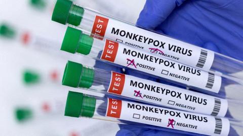 Lone monkeypox vaccine maker ready to meet demand