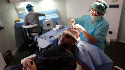 Hair transplant industry gives Türkiye’s medical tourism a B boost