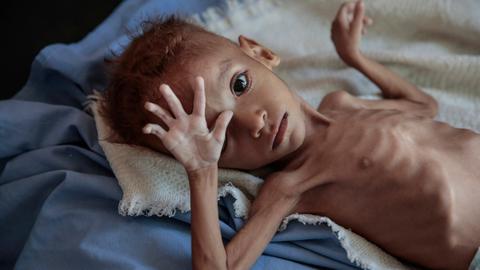 UN food agency accuses Yemen's Houthis of diverting food aid