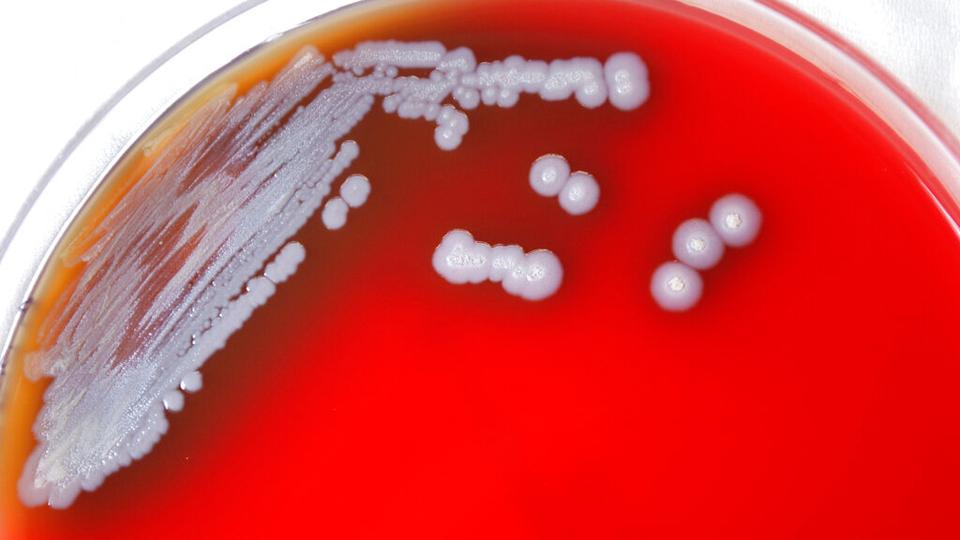 The bacteria can cause melioidosis, a rare and sometimes deadly disease long thought to be confined to tropical climates.