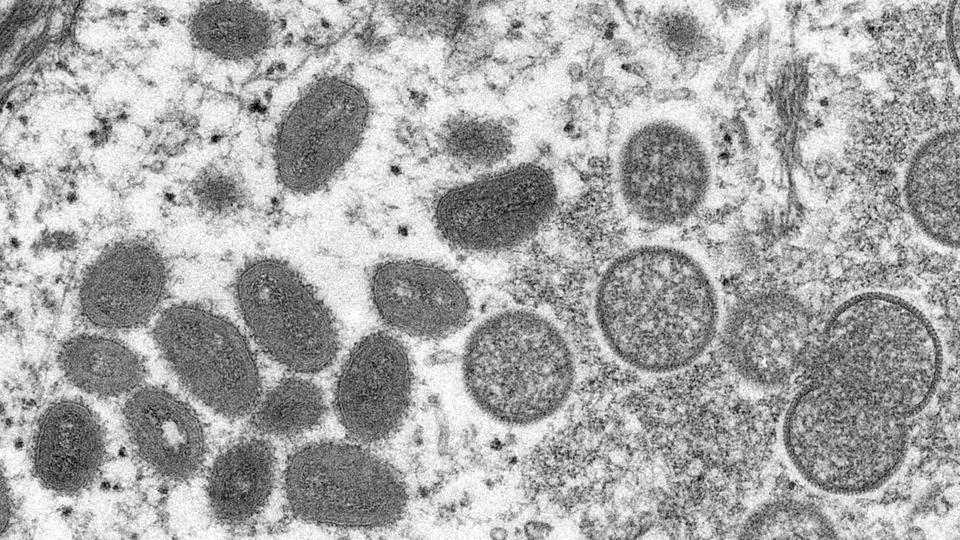 An electron microscopic image shows mature, oval-shaped monkeypox virus particles as well as crescents and spherical particles of immature virions.