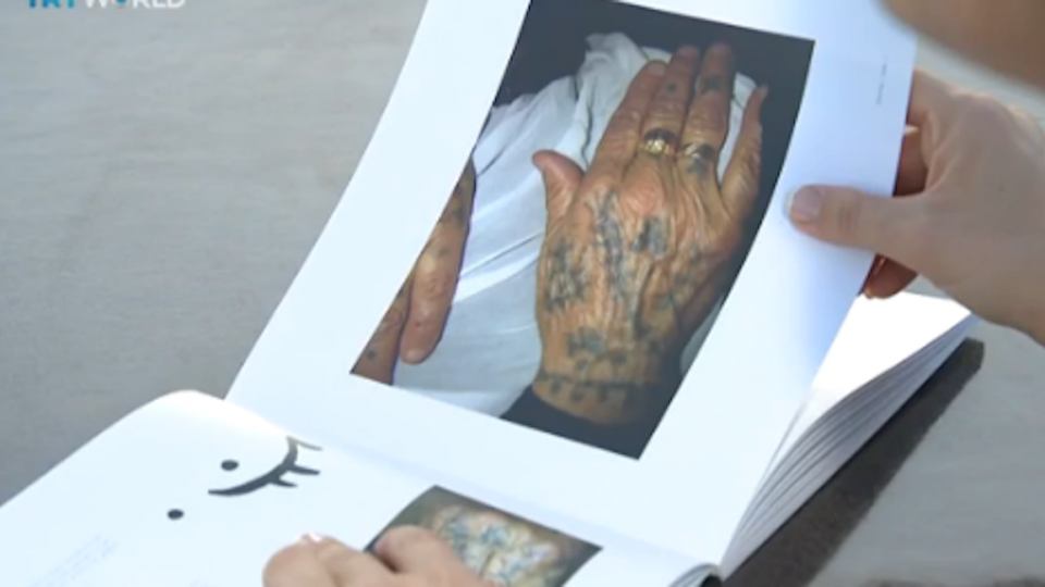 Deq tattoos: A dying tradition in Turkey
