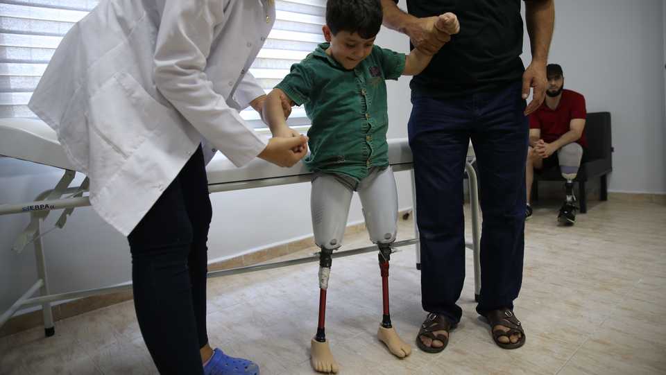 A ten years old Syrian boy named Abdulbasit Alsattuf (C), lost both of his legs in an airstrike in Syria, receives prosthetic legs in Reyhanli district of Hatay, Turkey on September 29, 2017.