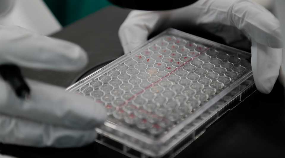 A scientist examines Covid-19 infected cells during research for a vaccine against the coronavirus disease at a laboratory of BIOCAD biotechnology company in Saint Petersburg, Russia on May 20, 2020.