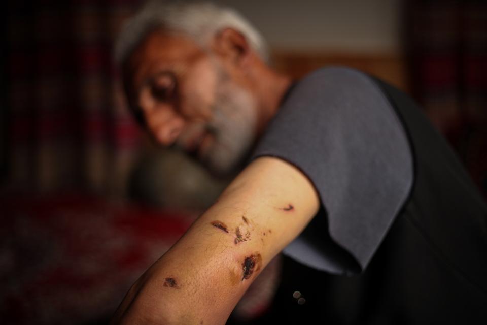 Mushtaq Ahmed, un consilier al vieții sălbatice, a fost una dintre victimele unui atac de leopard asupra unui sat din Kashmirul de Sud, pe 24 februarie 2021.