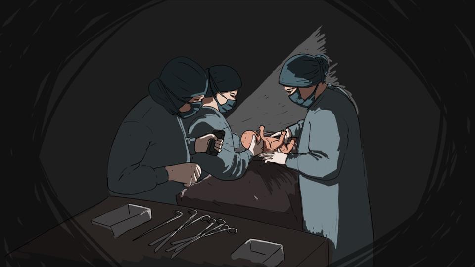 An illustration showing doctors conducting a c-section using cellphone flashlights (TRTWORLD)