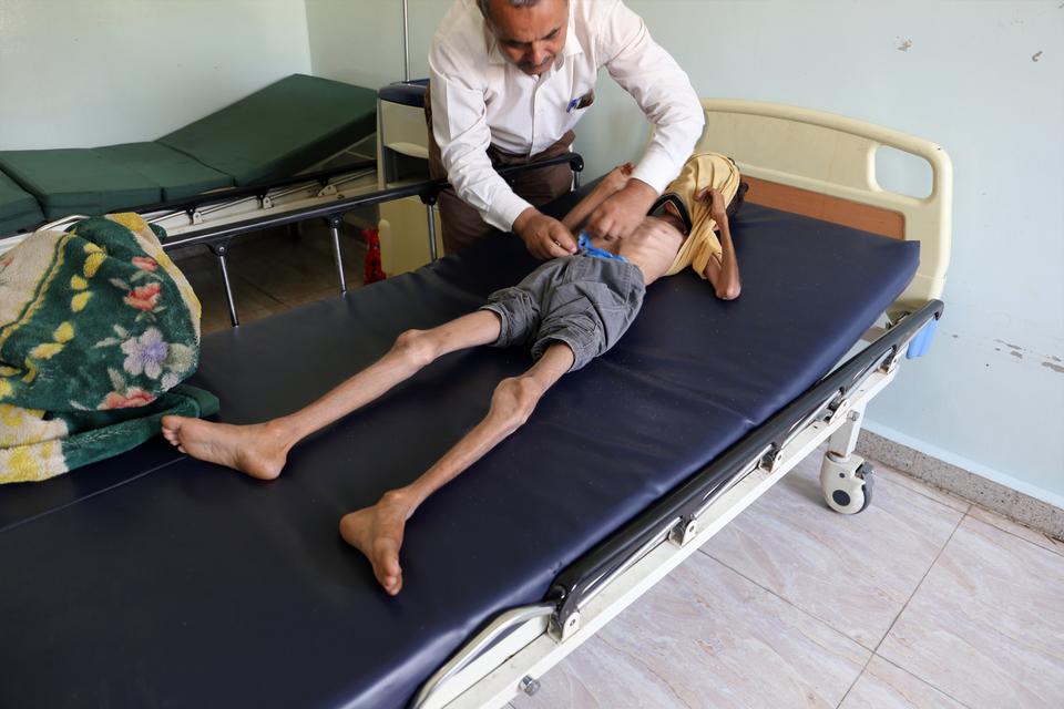 A doctor inspects Yemeni boy Ghazi Ali bin Ali, 10, suffering from severe malnutrition as he lies on a bed at a hospital in Jabal Habashi on the outskirts of the city of Taiz, on October 30, 2018.